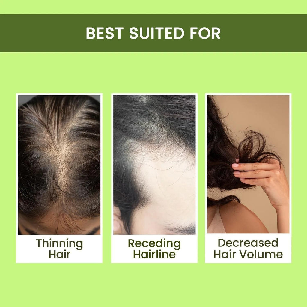 Rosemary Water Hair Spray for Regrowth – Buy 1 Get 2 Free (Pack of 3, 100 ml)