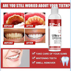 SP-4 Ultra+ Whitening Teeth (Pack of 1)