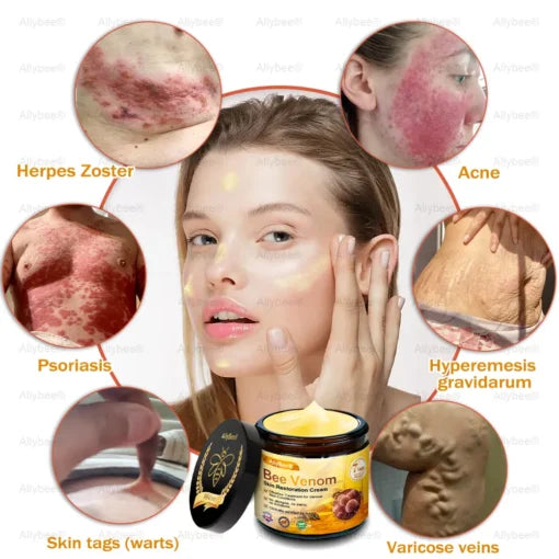 Bee Venom Skin Treatment Cream – Pack of 2 (100 g Each) Anti-Aging & Firming