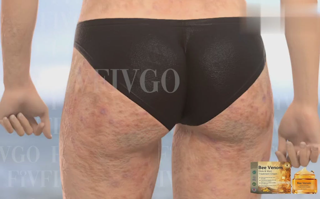 Bee Venom Skin Treatment Cream – Pack of 2 (100 g Each) Anti-Aging & Firming