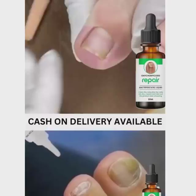 Nails Strong Growth And Repair Oli 30 ML ( Pack Of 1)