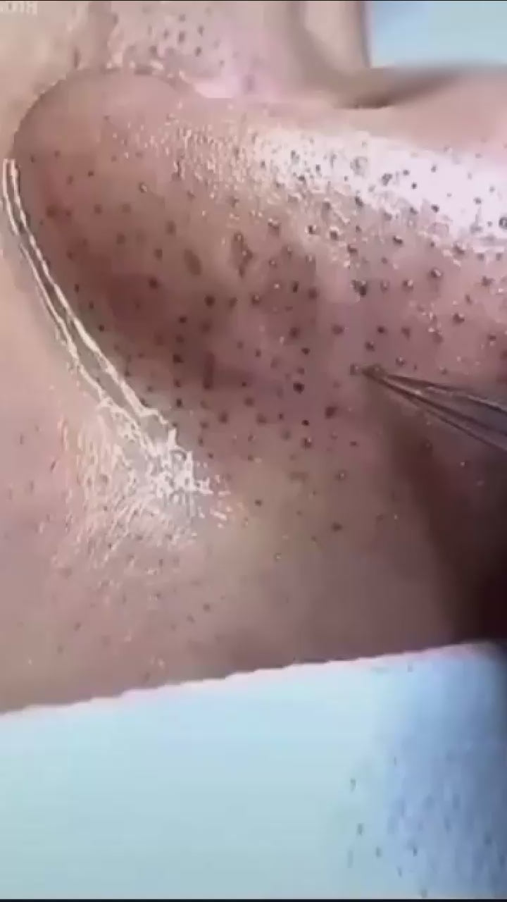 Green Tea Herbal Mask Stick – Deep Blackhead Removal & Pore Cleansing